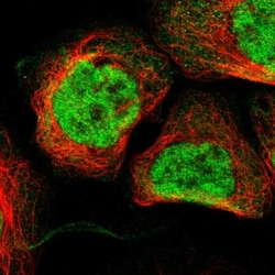 GM632 Antibody, Novus Biologicals 0.1mL; Unlabeled:Antibodies, Polyclonal